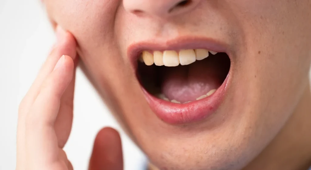 Wisdom Teeth in Brooklyn, NY: Signs, Removal, and Recovery